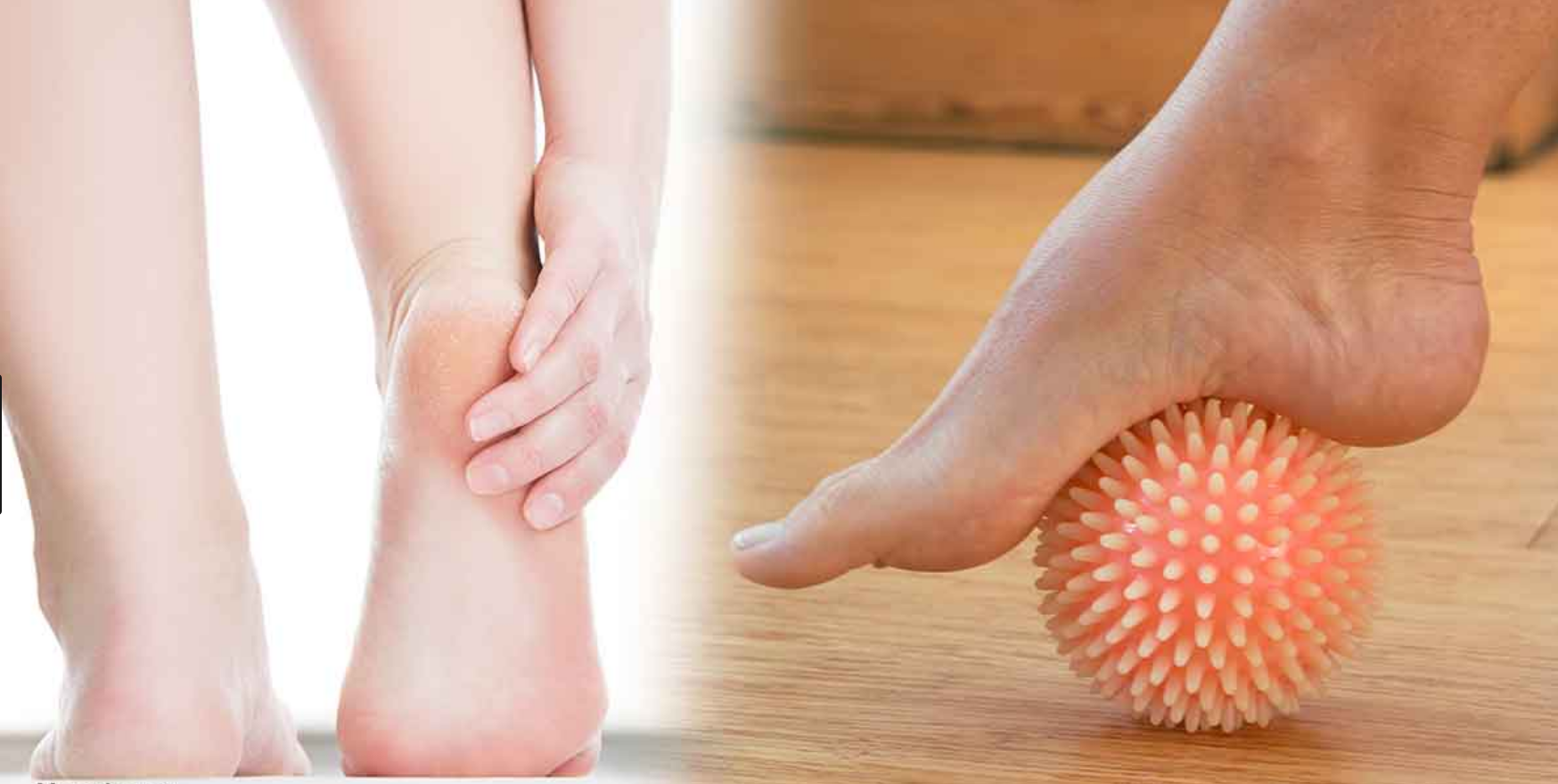 Pro Sports Orthopedics advice What is best treatment of Plantar Fasciitis