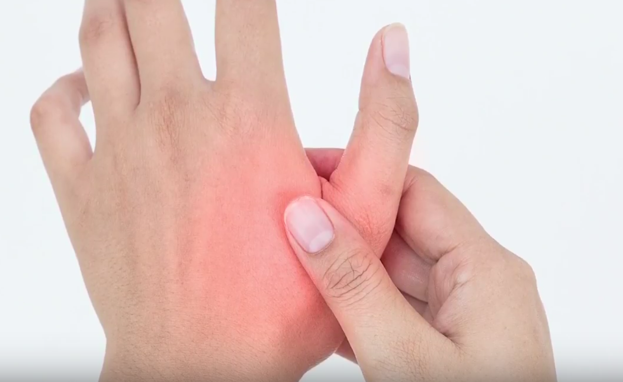 Thumb Arthritis AOA Orthopedic Specialists