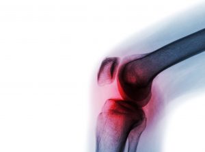 Knee Joint