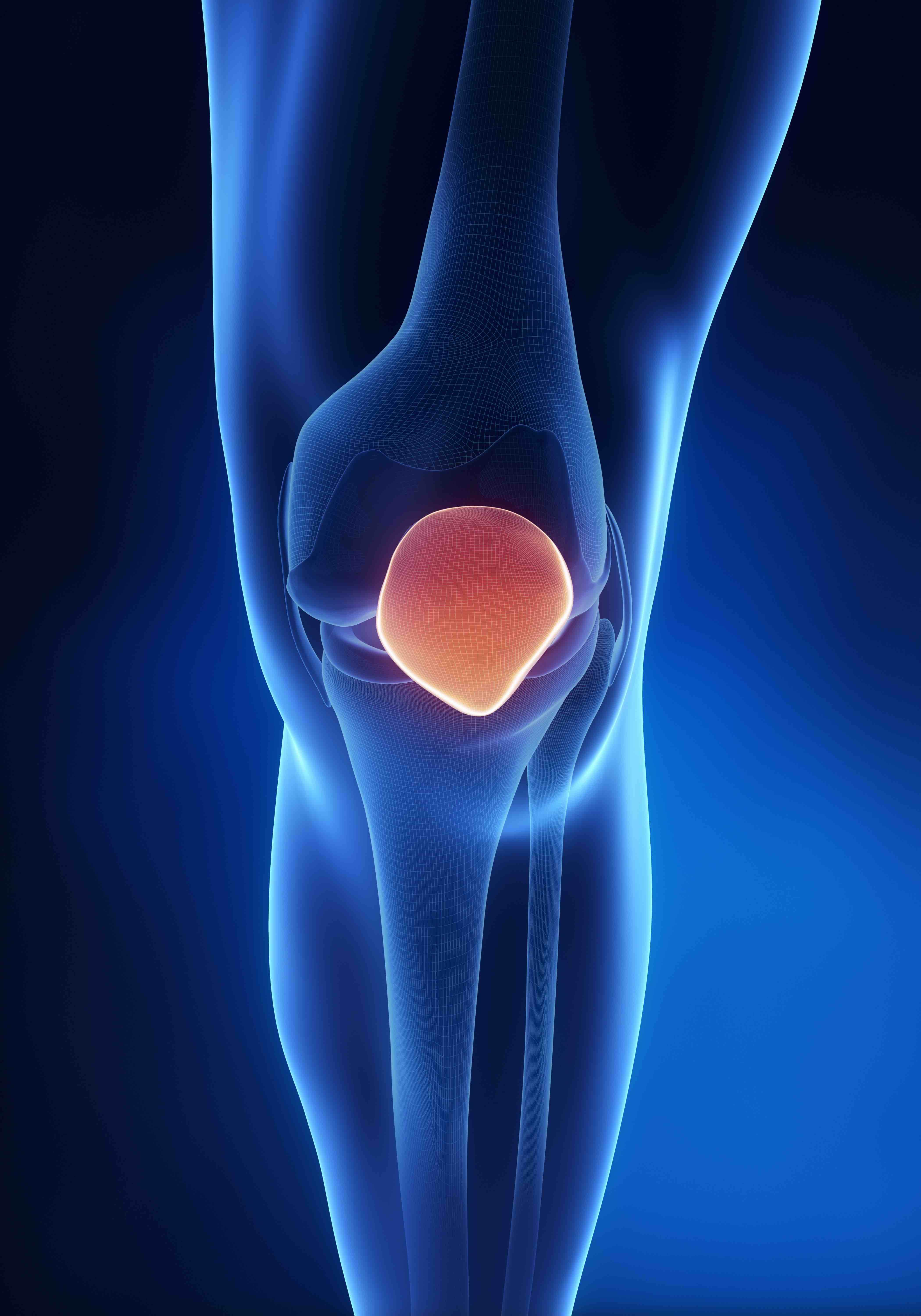 Osgood Schlatters Disease Knee