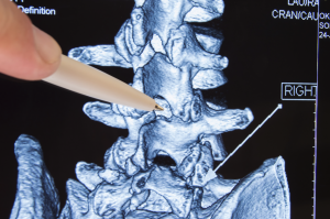 spine