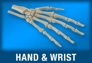 Hand/Wrist injuries