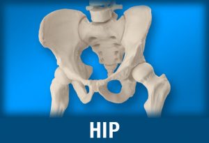 Hip injuries