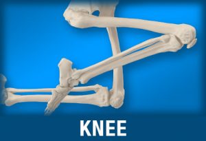 Knee injuries