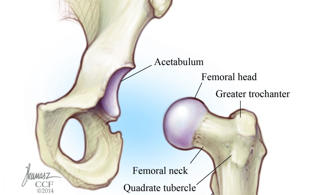 Hip Impingement