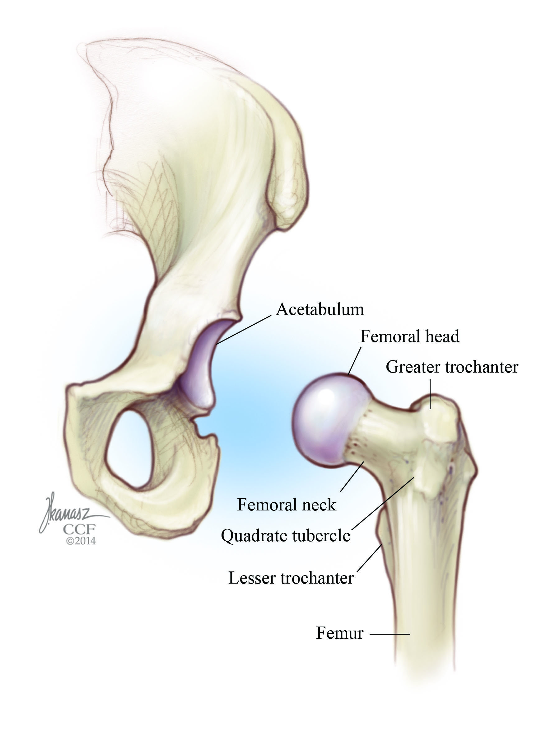 Hip - Hemiarthroplasty - AOA Orthopedic Specialists